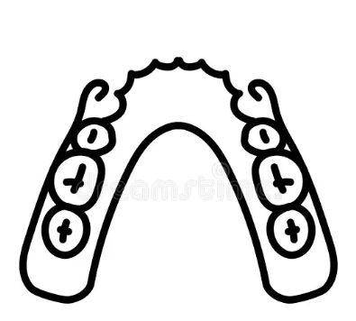 denture, partial denture, full denture